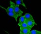 Neuropilin-1 Recombinant Rabbit mAb